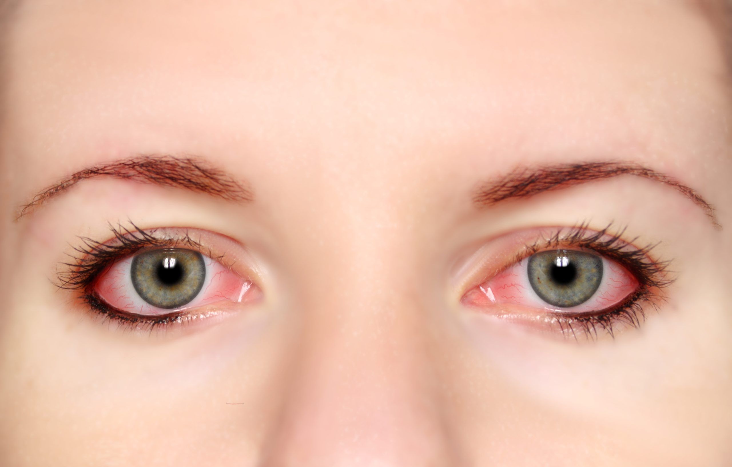 Loss of vision linked to air pollution